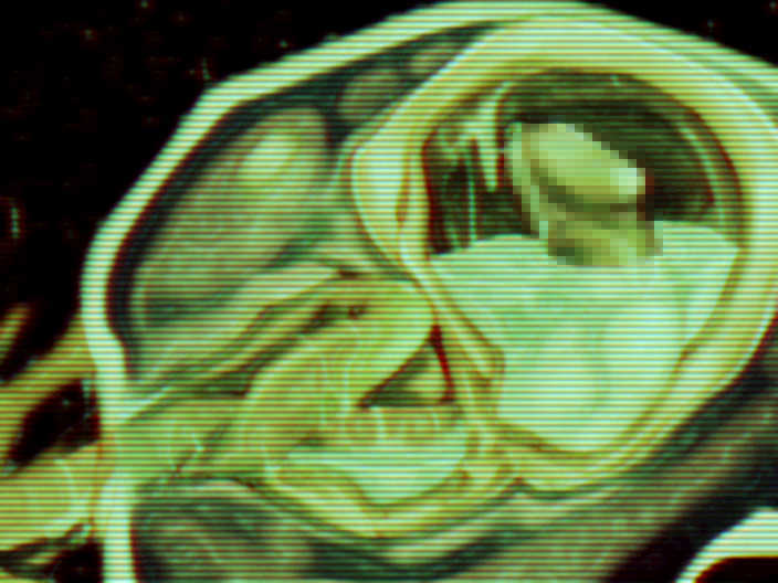 org_h_02