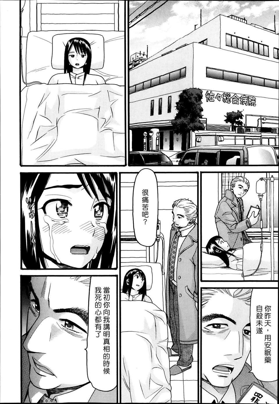 P314