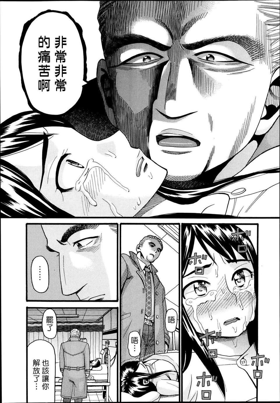 P315