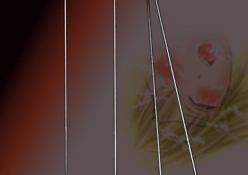 37