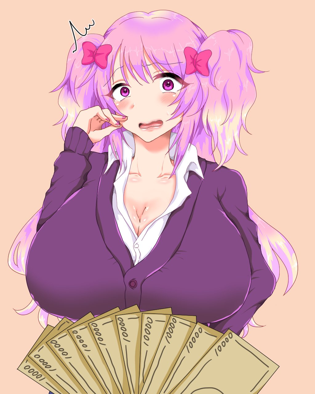 144