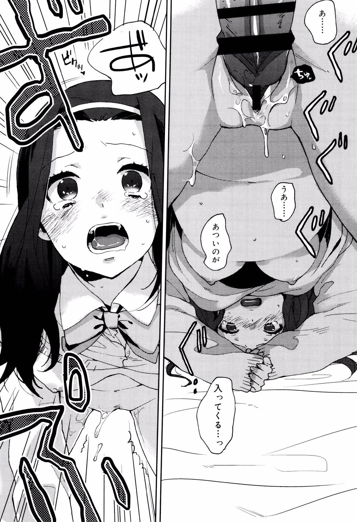 100