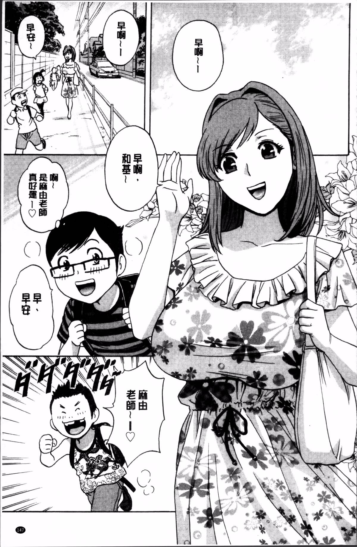 151