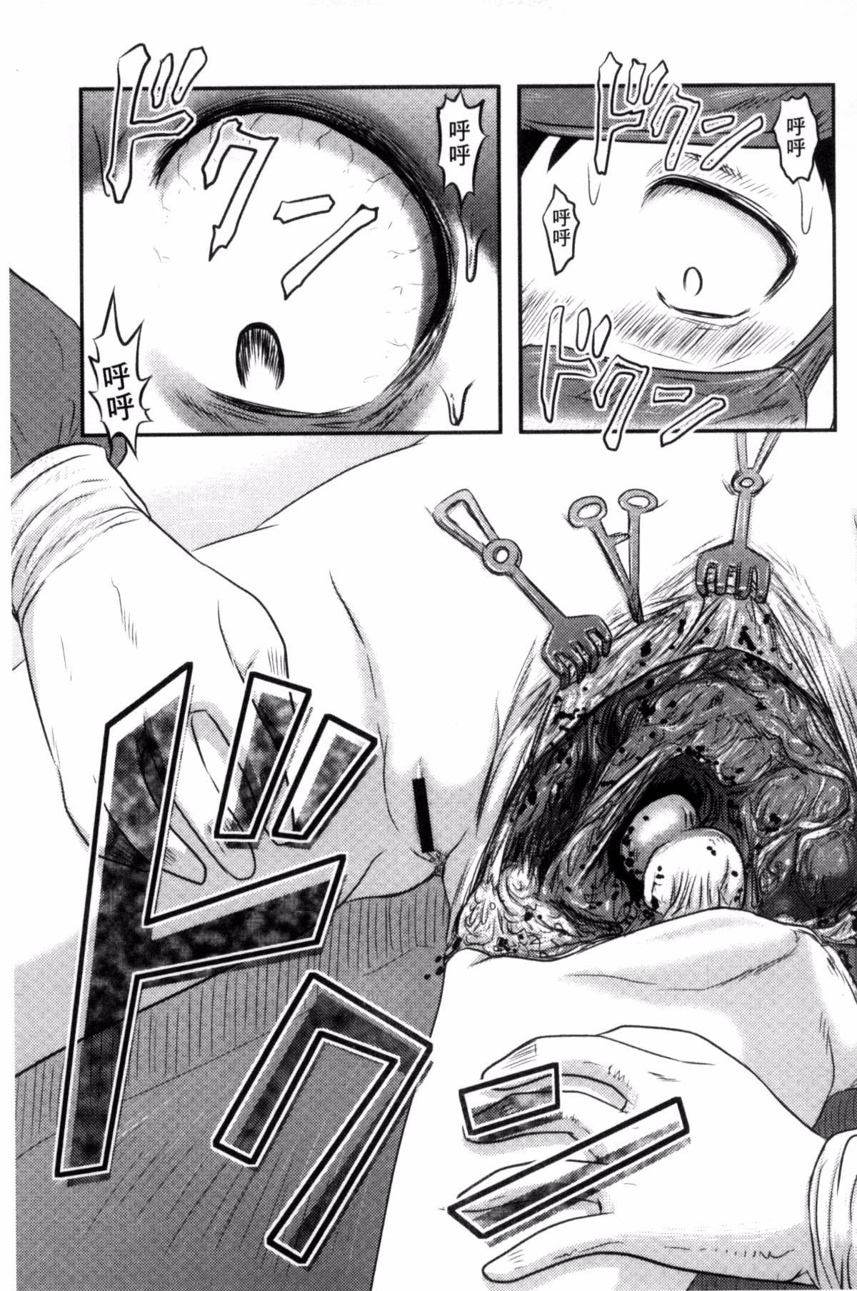 114