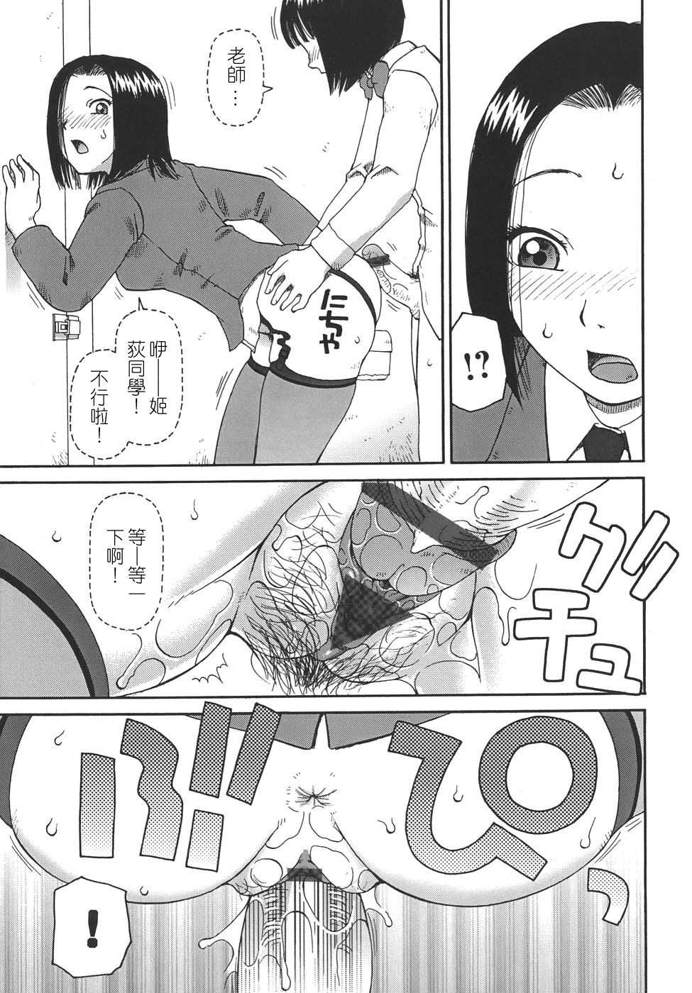 315