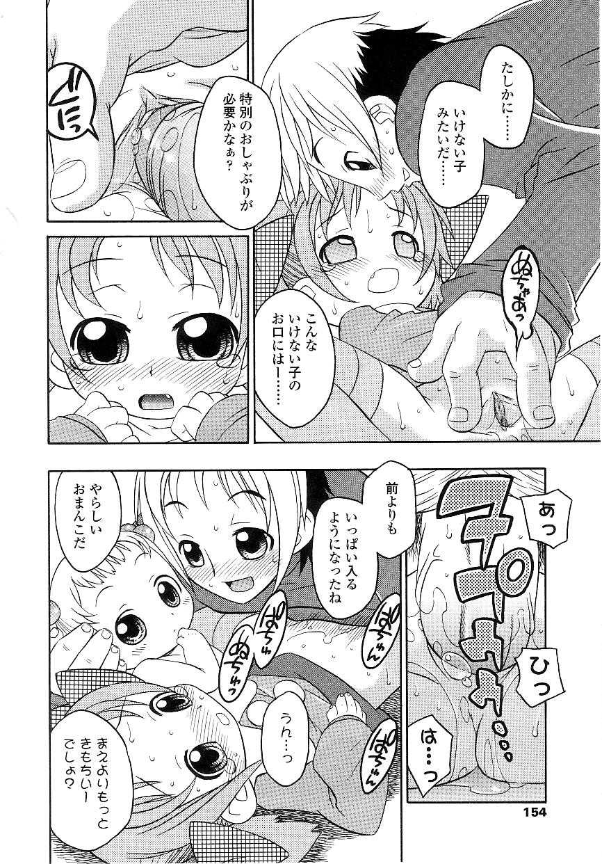 151