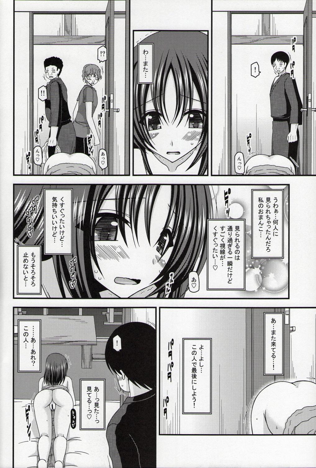 151