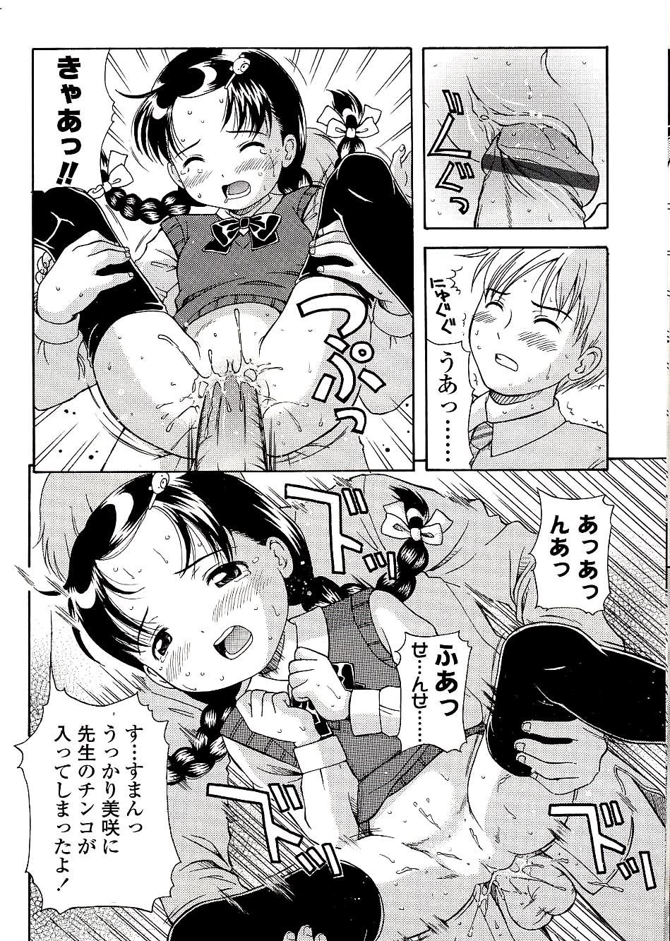 102