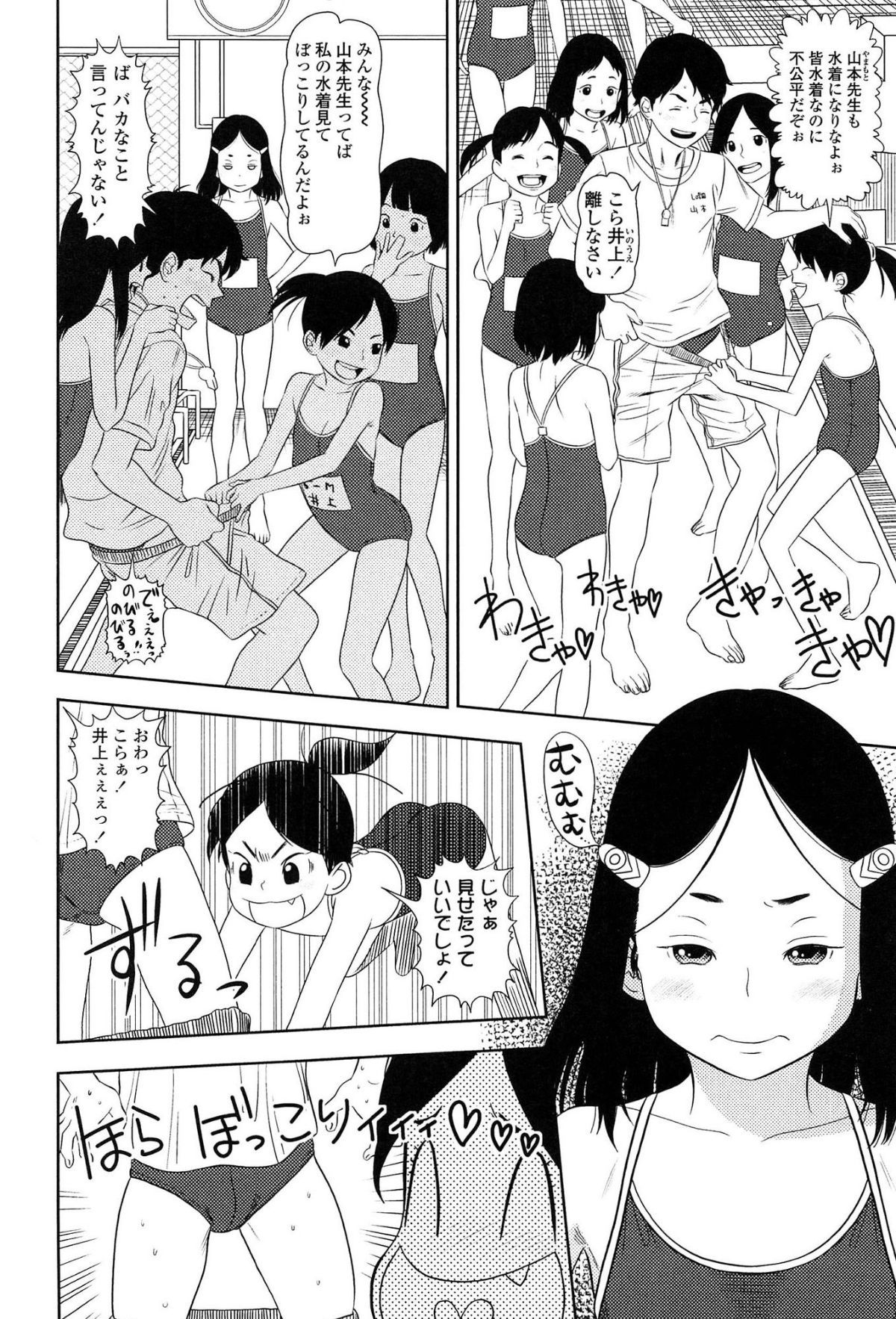 151