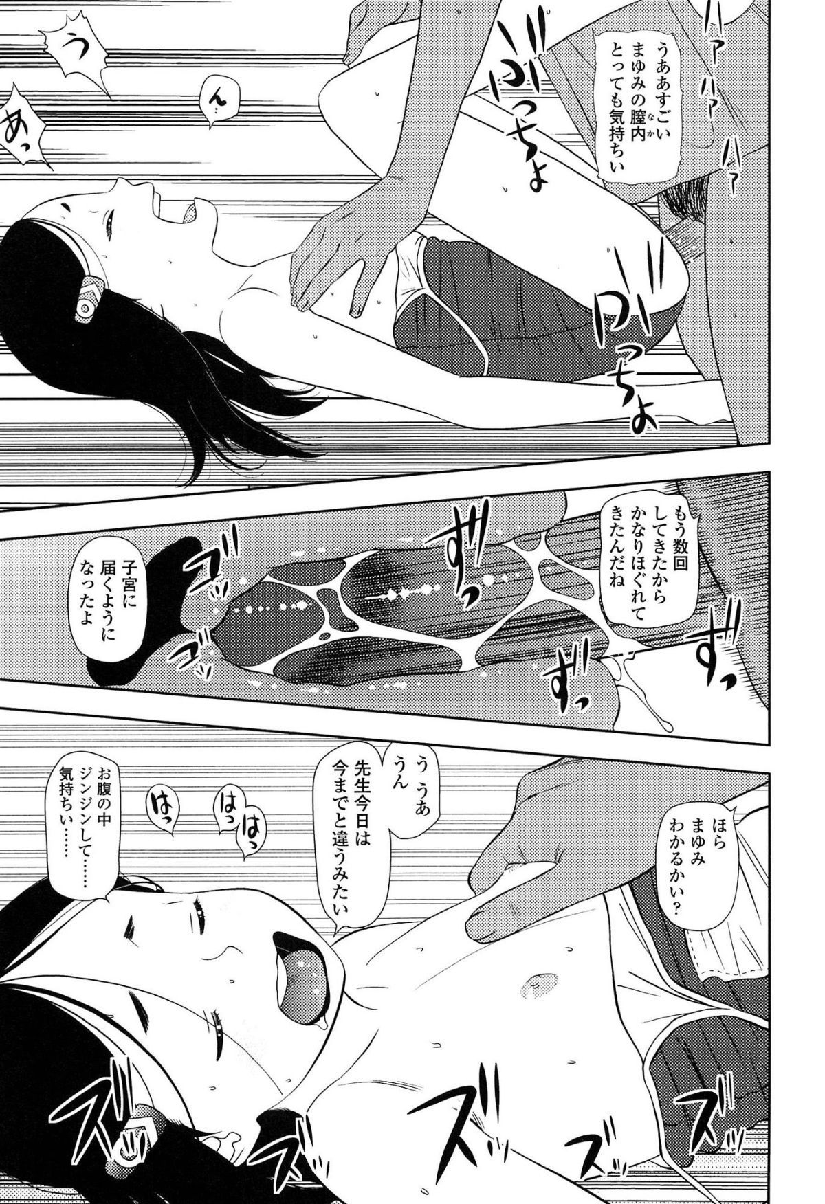 166