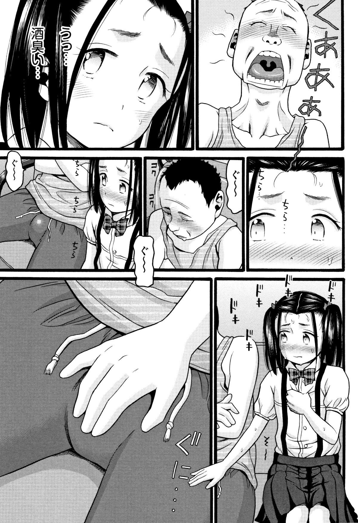 P177
