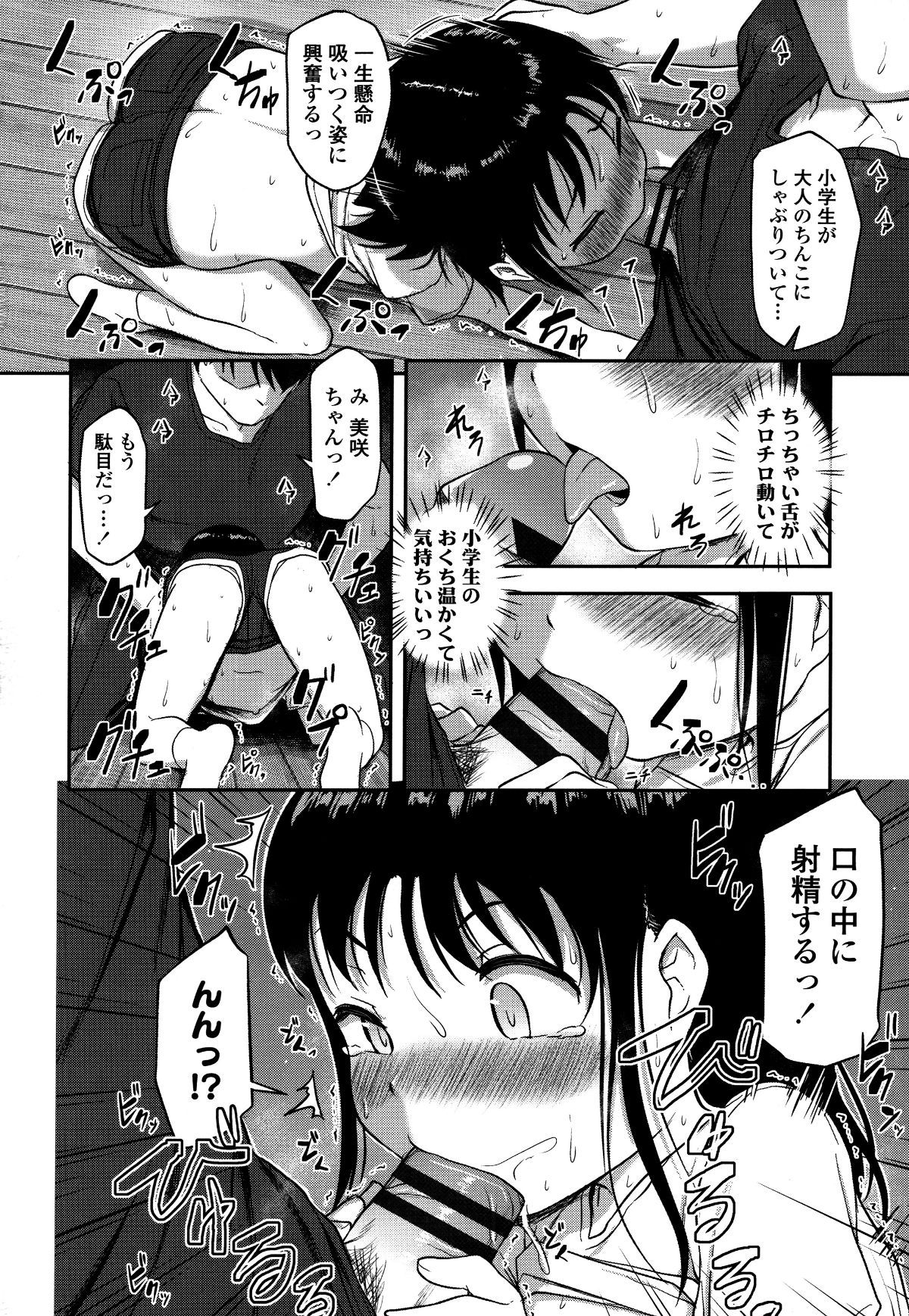 P076