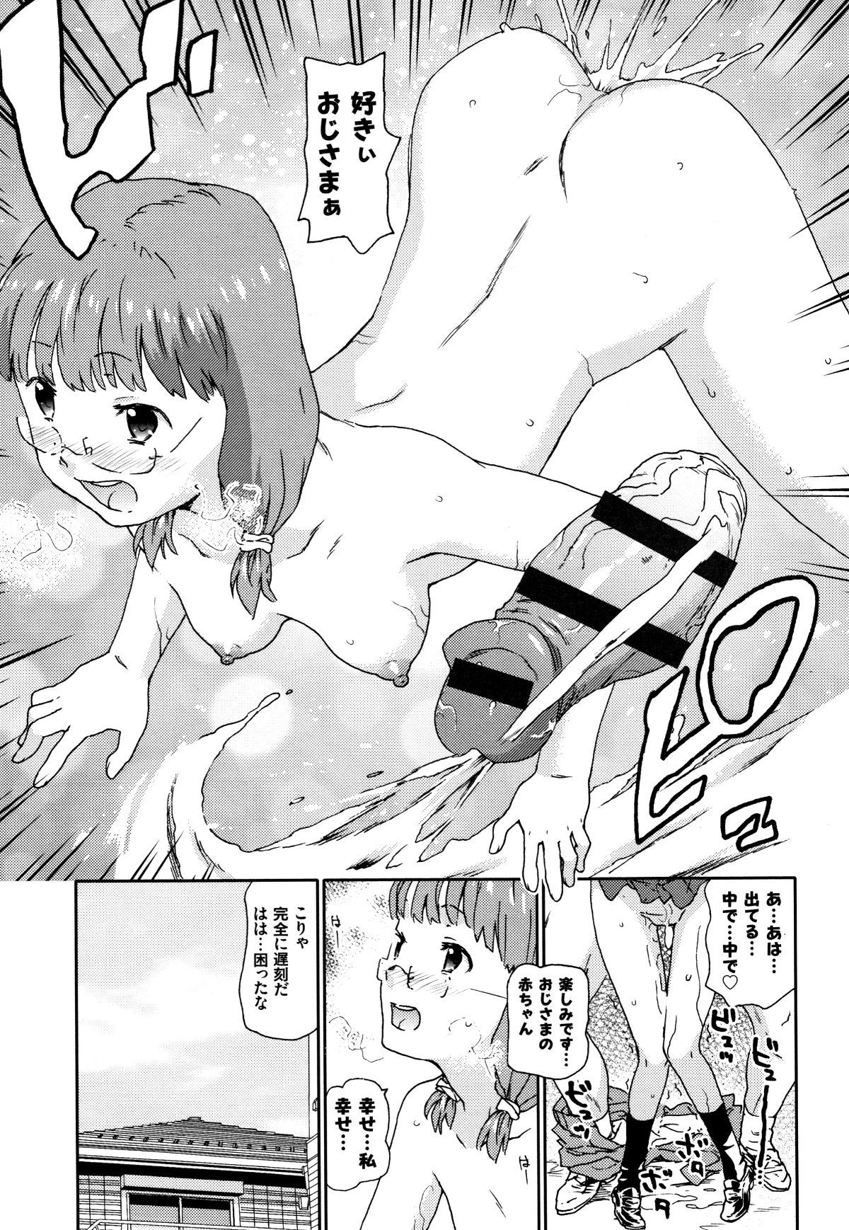 P171