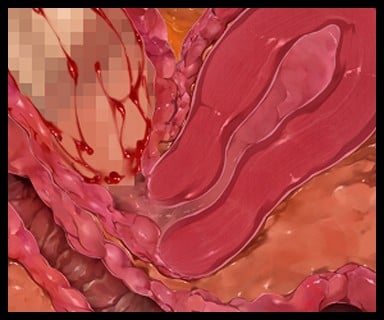 0340_zcu105a