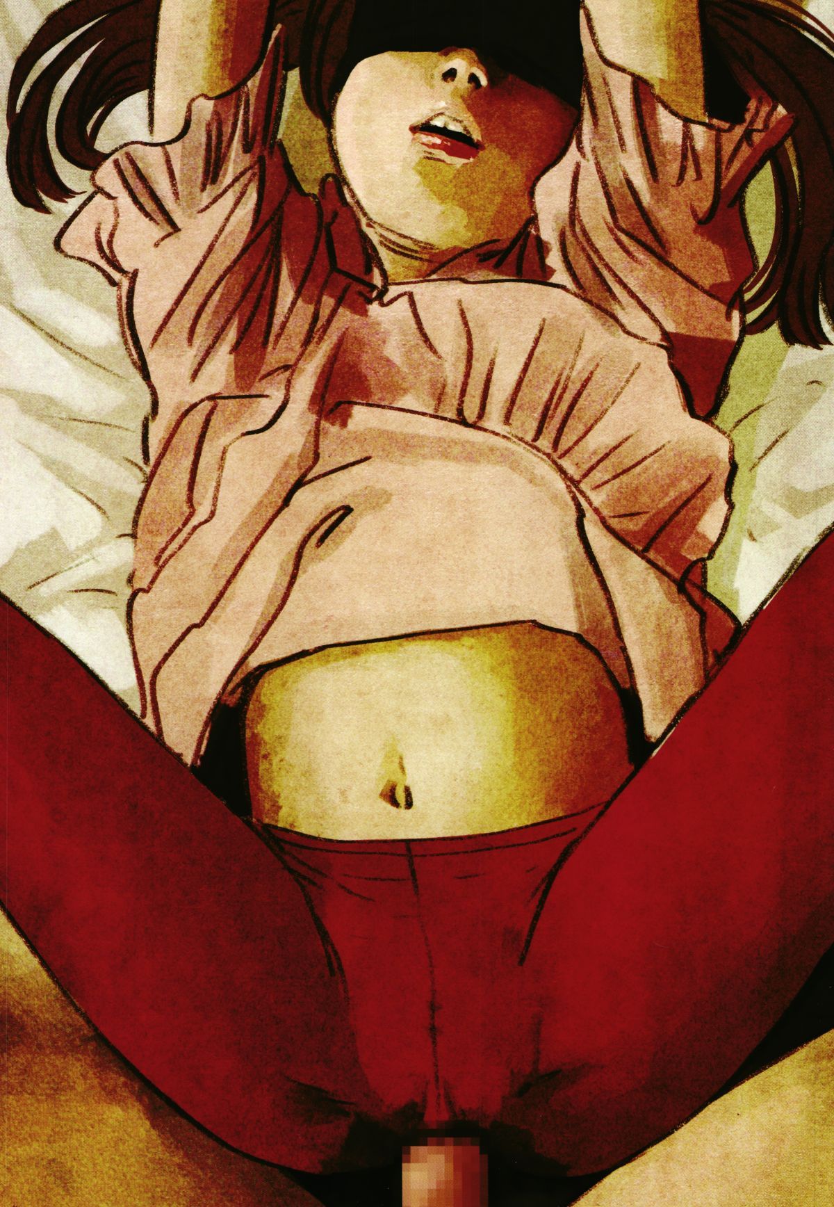 P314