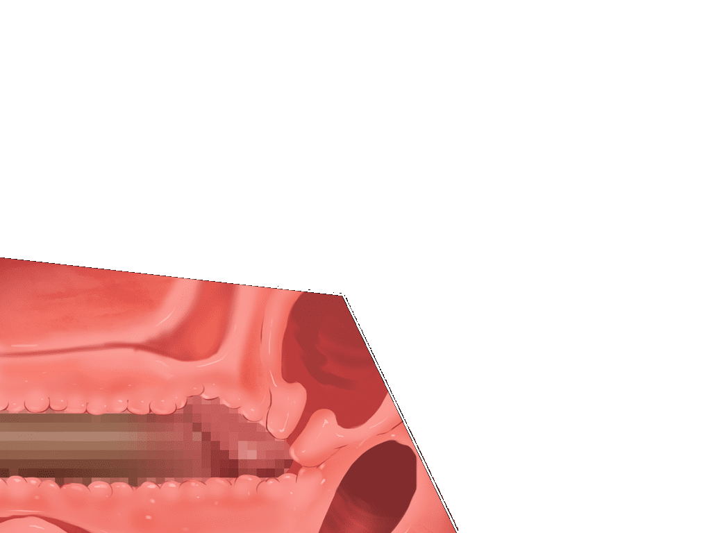 059_da04r2