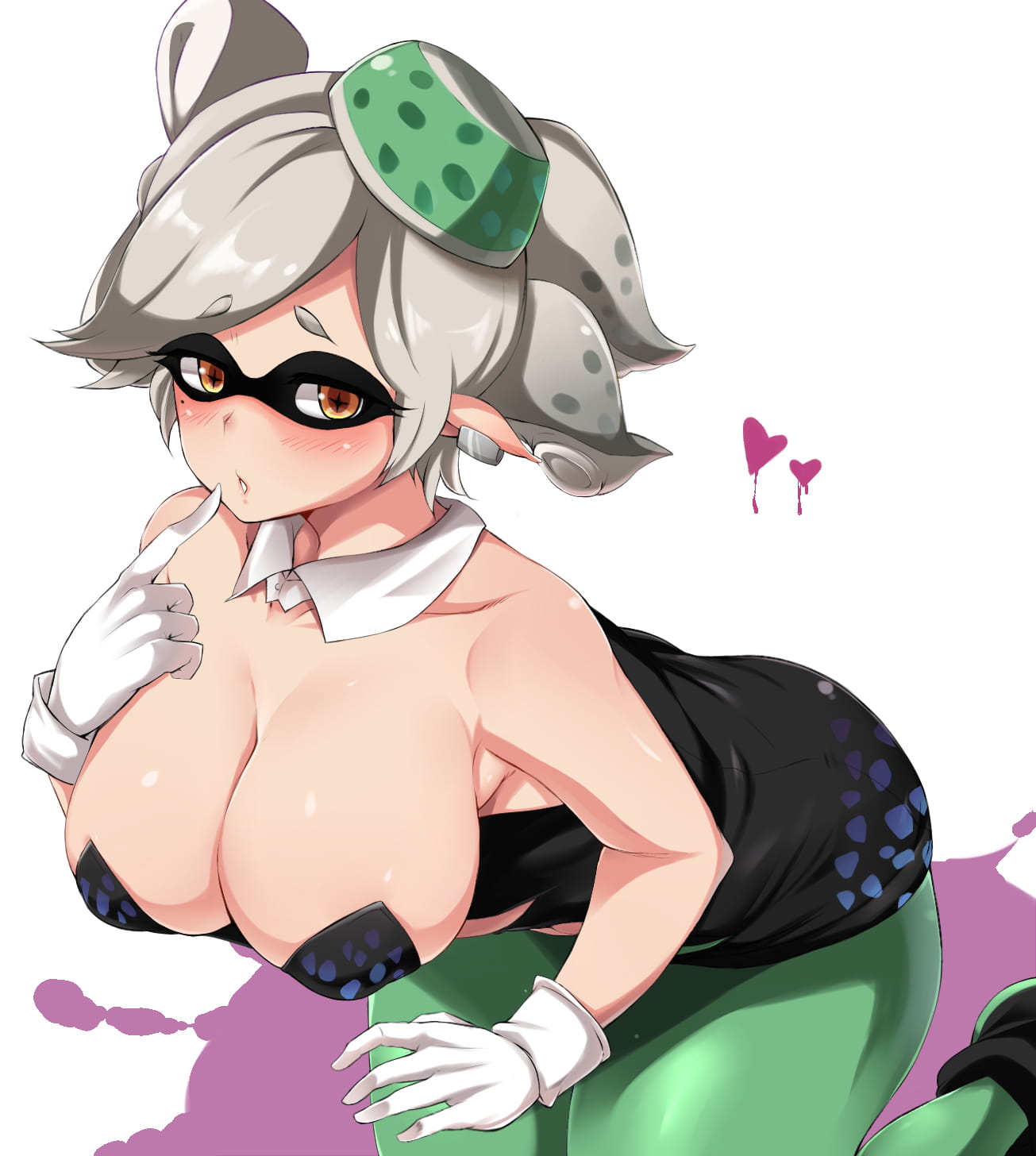 310