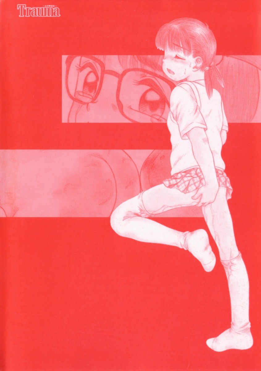 00 (156)
