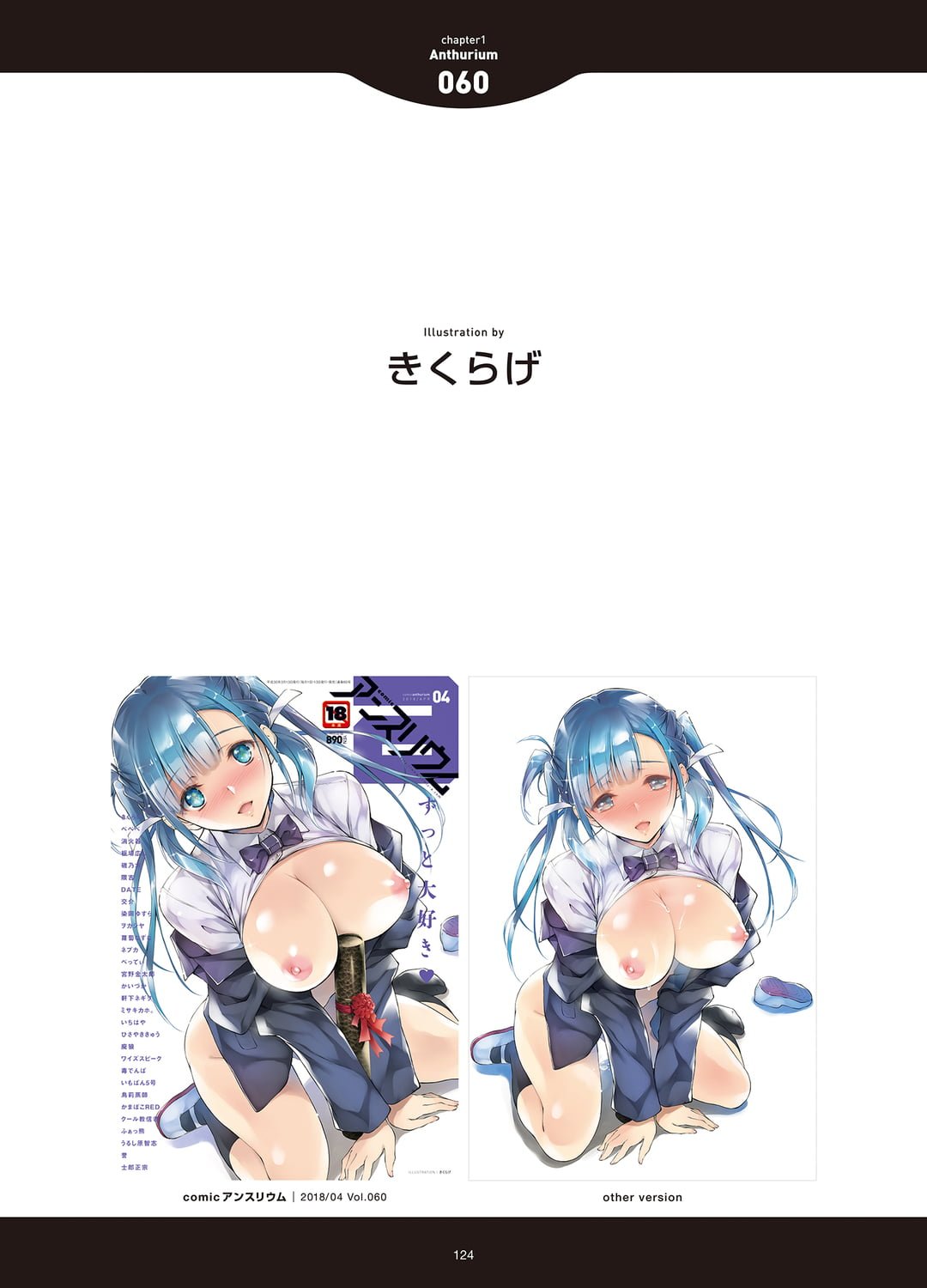 122