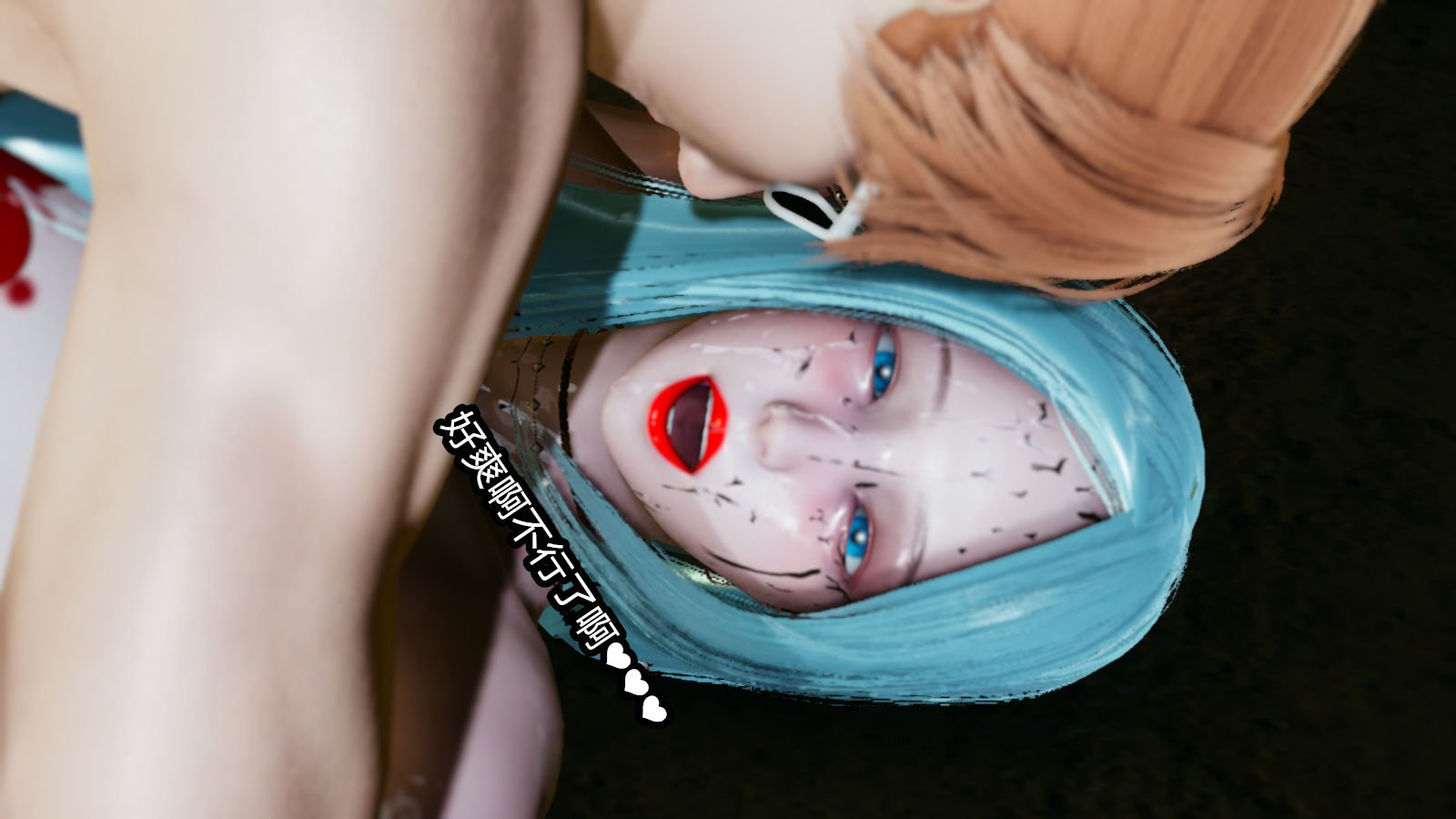 00176