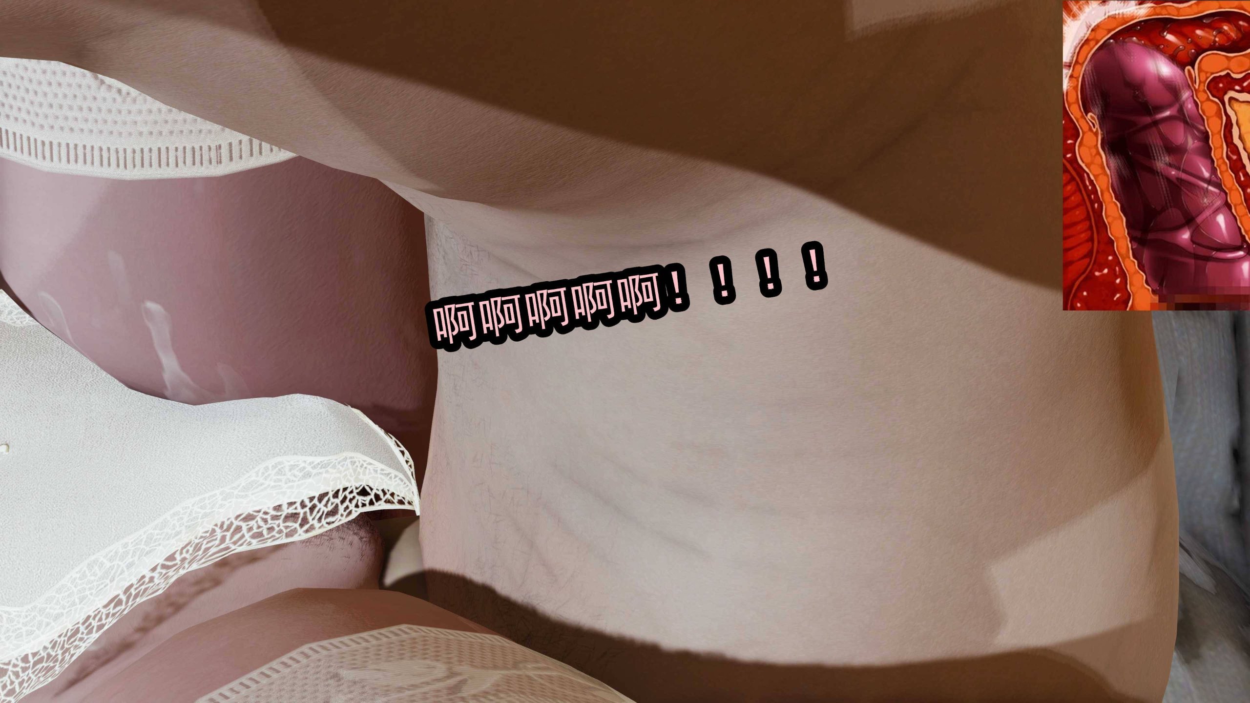 00972