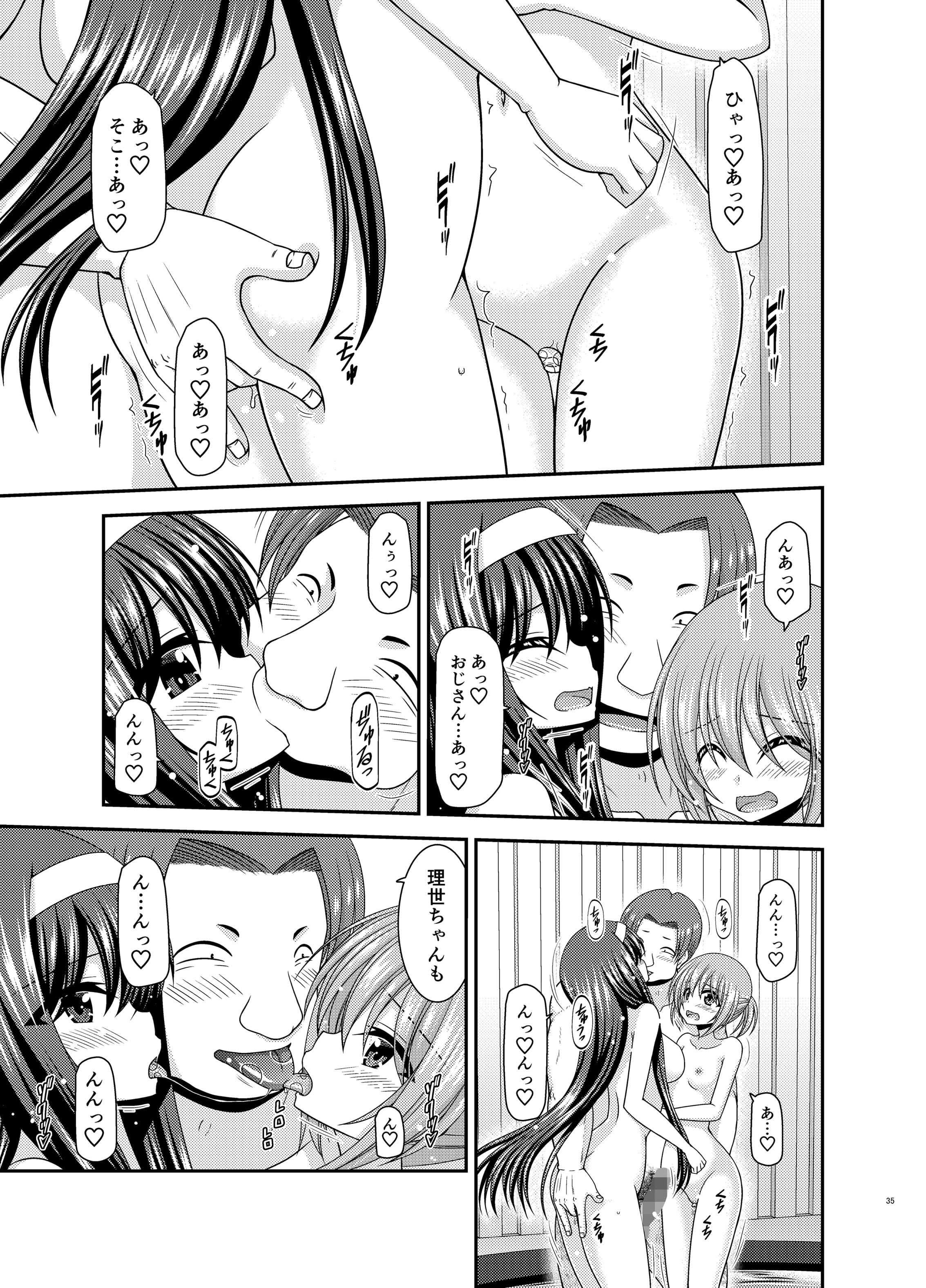 34