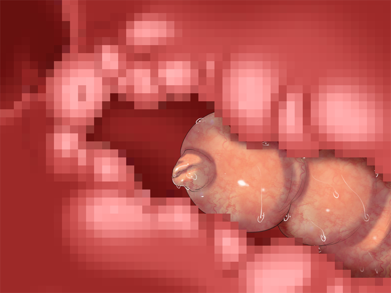 ev04001a01