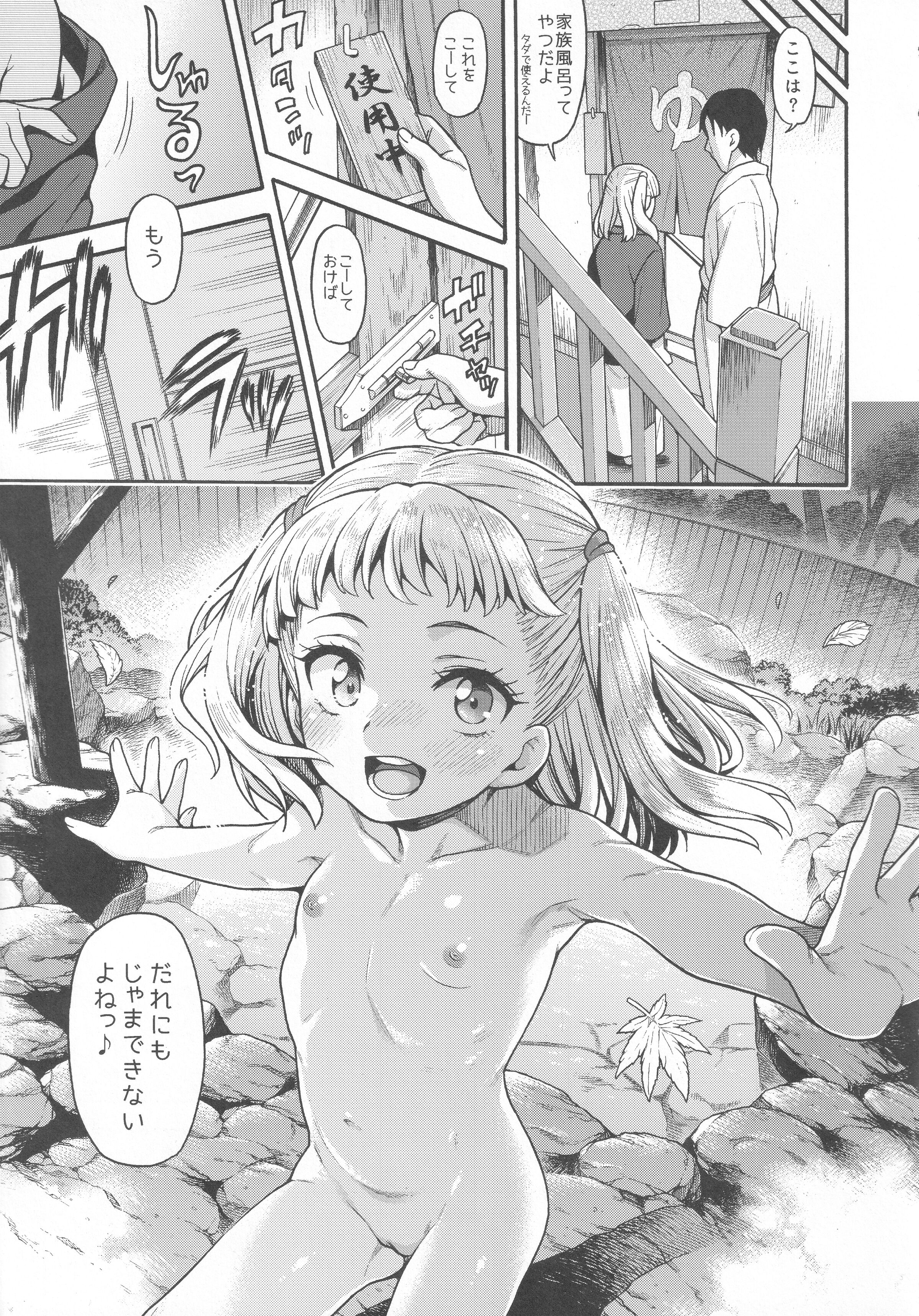 100
