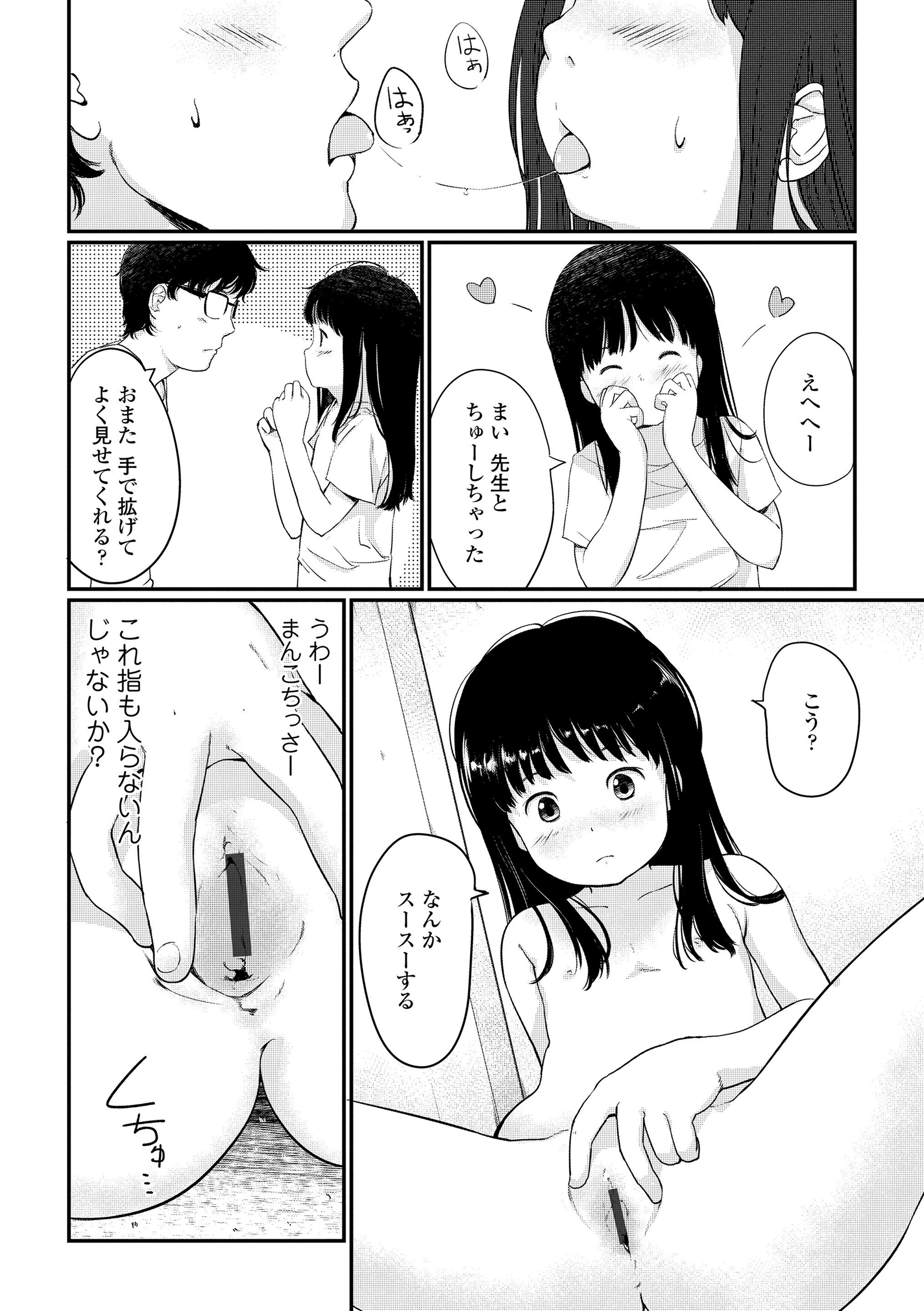 170