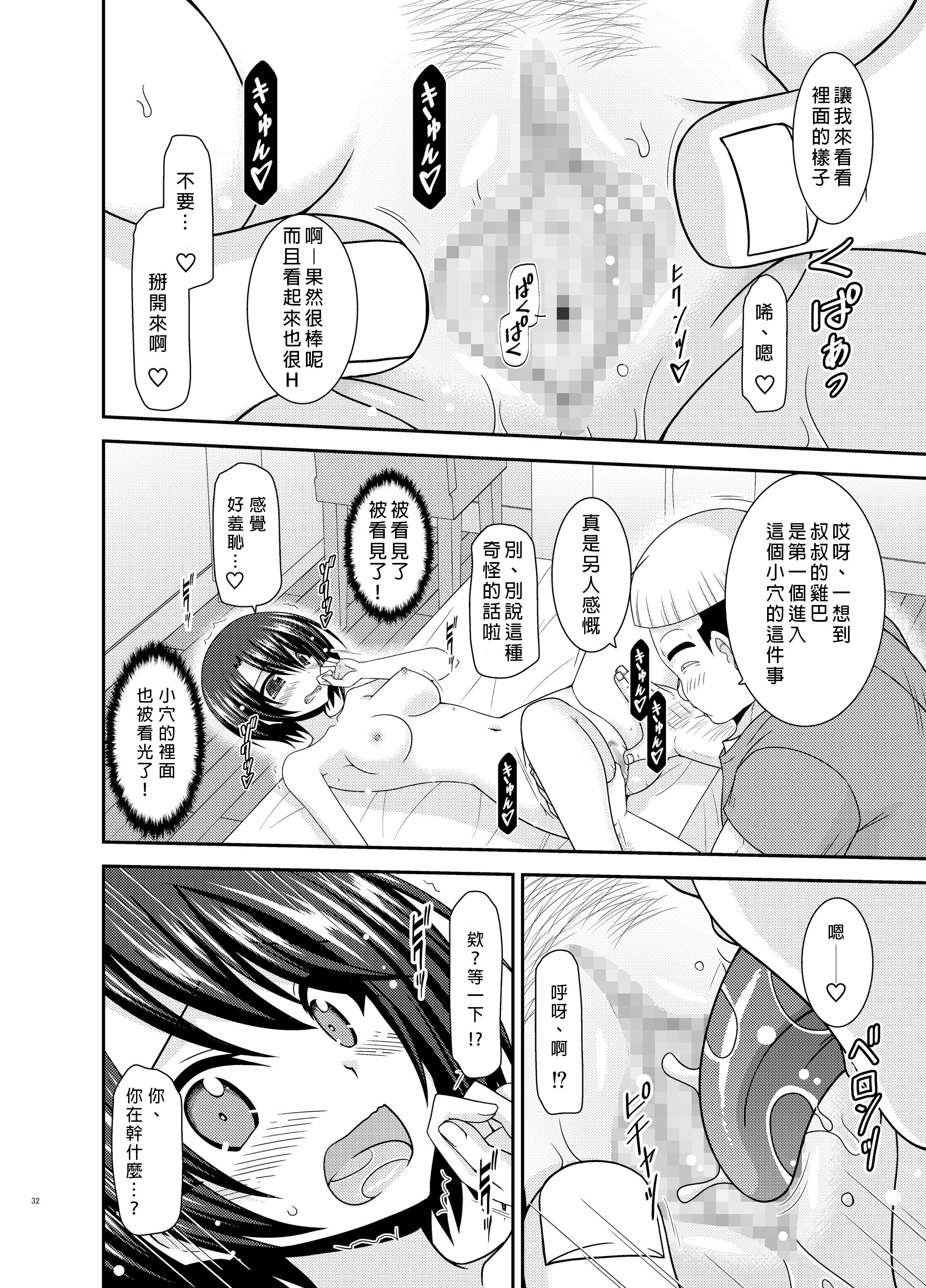 31