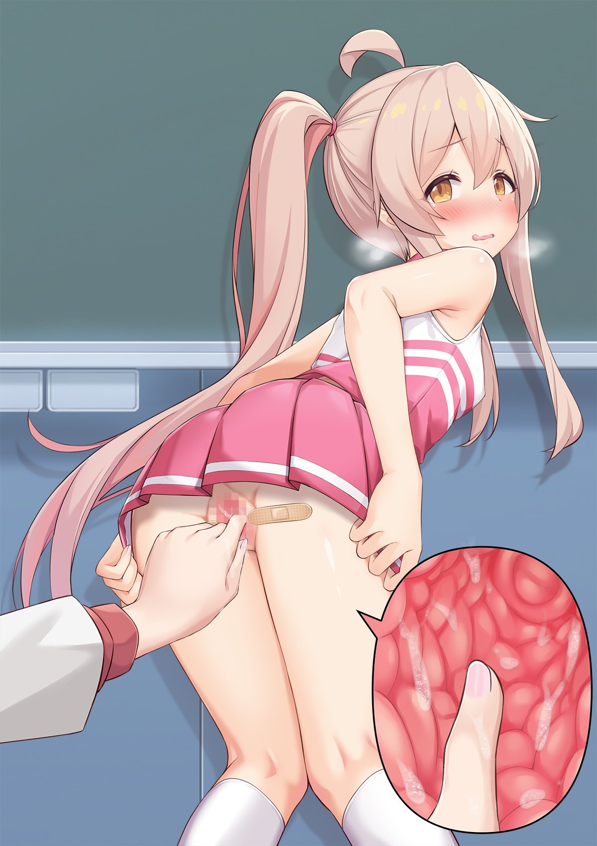 193