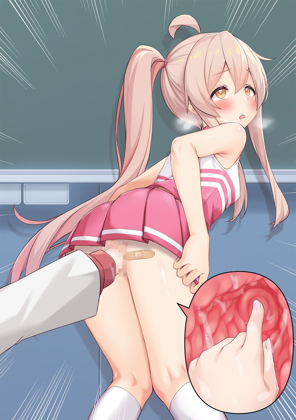 194