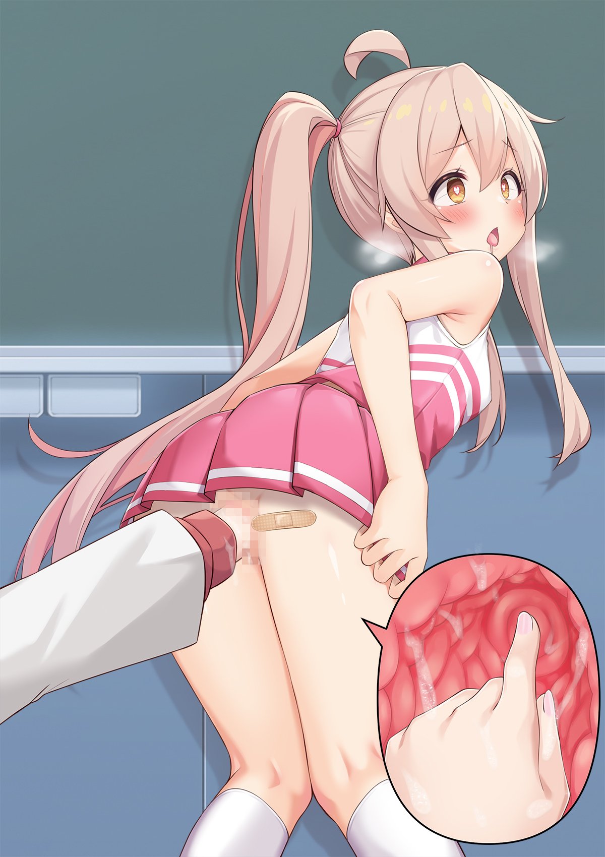 195