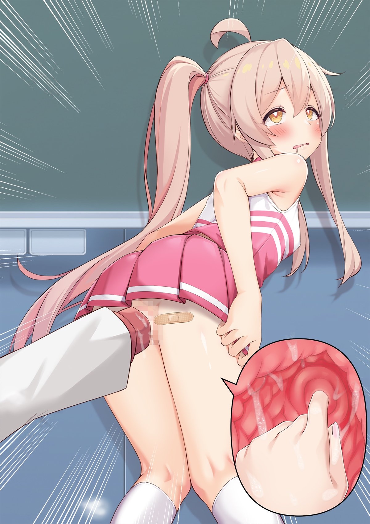 196
