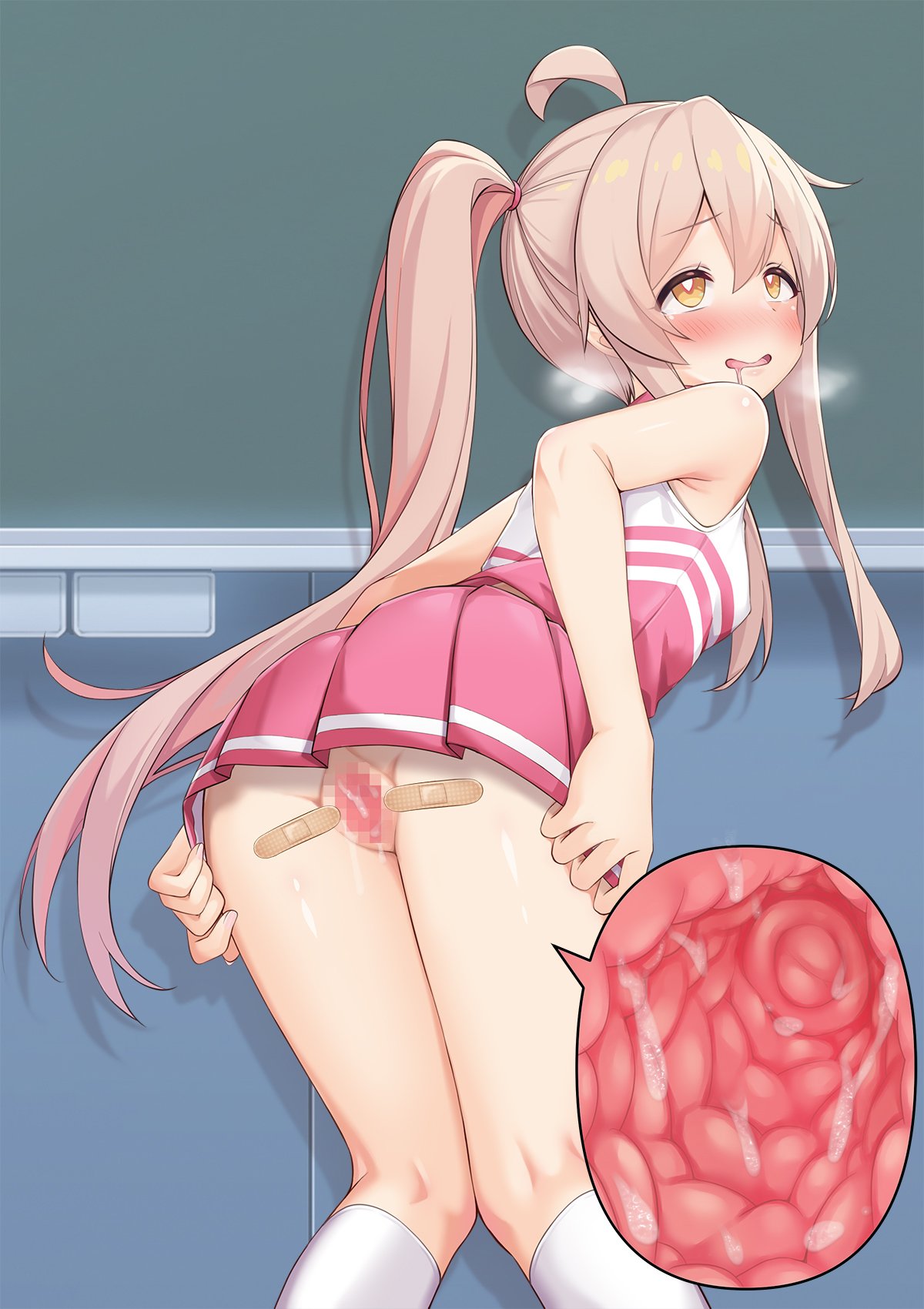 199