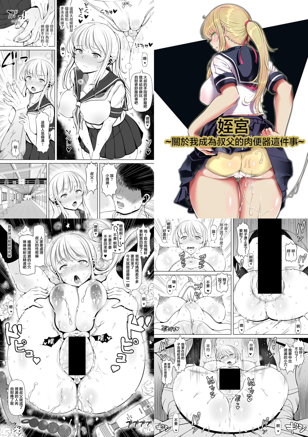 155